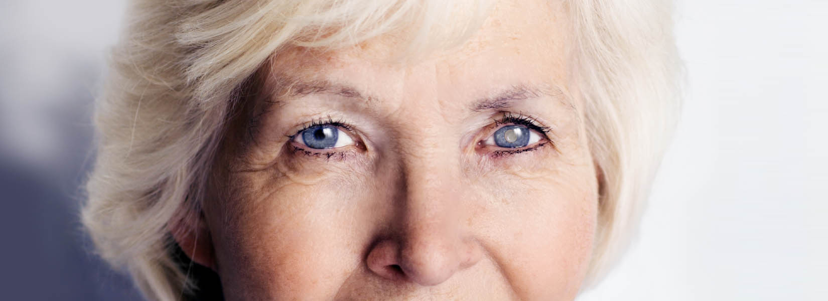 Cataract Surgery in Peoria